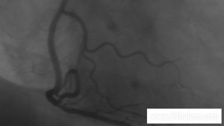 csm_original_image_22aa8fb205.png