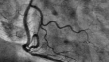 csm_equ_histo_image_rect_e3239f372d.png